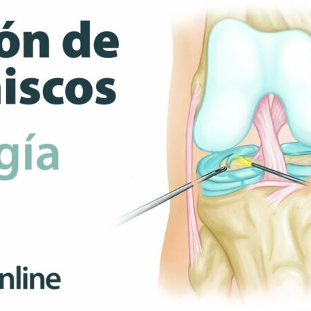 Duro golpe para el Sorrento: Bolsius sufre rotura de ligamento cruzado
