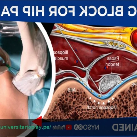Elland Road: El Corazón Histórico del Leeds United